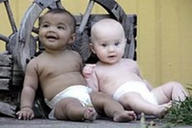 10 cặp sinh đôi đặc biệt nhất thế giới