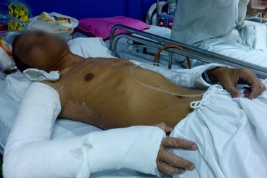 Hà Nội: Đang ngồi uống nước ở vỉa hè, bị nhóm côn đồ xông vào đánh trọng thương