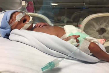 Bé trai thụ tinh ống nghiệm chào đời chỉ nặng 0,8kg