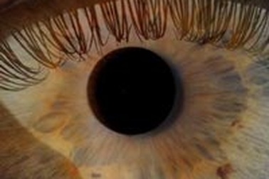 Hội chứng khô mắt khô miệng