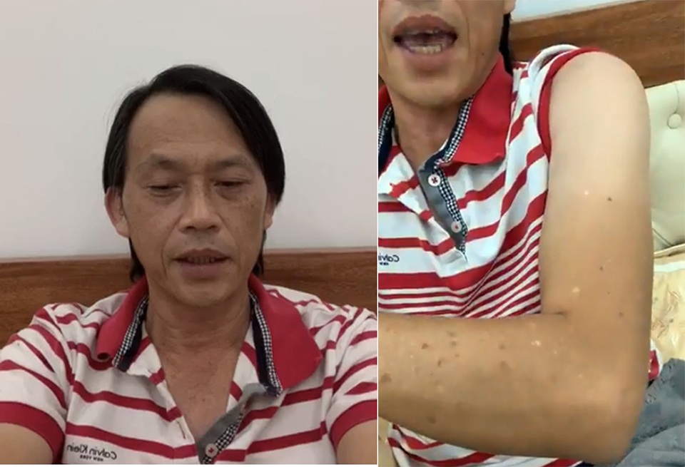 Hoài Linh tiết lộ về cuộc sống “ẩn cư” trong thời gian dài - 4 Hoài Linh tiết lộ về cuộc sống “ẩn cư” trong thời gian dài - 4