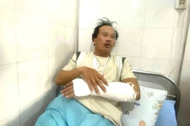 Giám định thương tích trạm trưởng bị gãy tay khi ngăn nhóm người trồng rừng