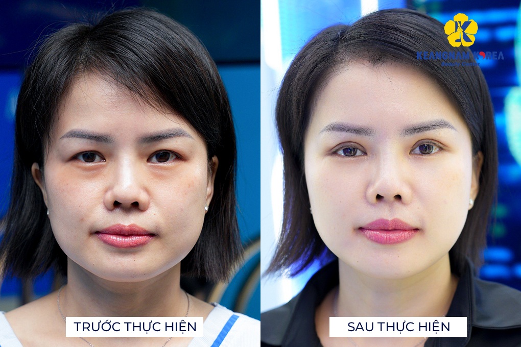 Hơn 500.000 ca thành công khơi dậy sức sống cho mắt tại Keangnam Korea - 2 Hơn 500.000 ca thành công khơi dậy sức sống cho mắt tại Keangnam Korea - 2
