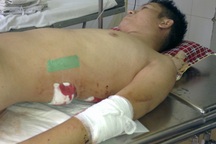 Một kỹ sư bị đâm chém dã man tại quận Hà Đông