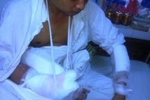 Bị chém lìa tay vì dám tán gái làng 