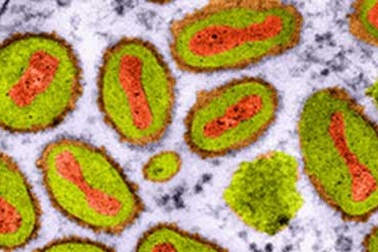 Triển vọng từ vi-rút chống ung thư 