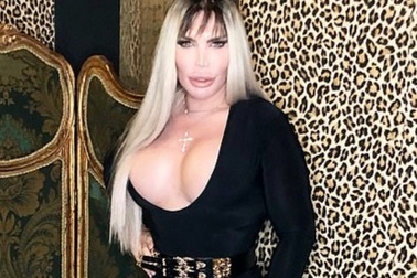 Rodrigo Alves tiếp tục phẫu thuật chuyển giới