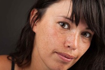 Khi lá gan bị xơ hóa sẽ xuất hiện những thay đổi này trên cơ thể