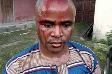 Bị vợ đánh vỡ đầu vì dám chê nấu ăn dở