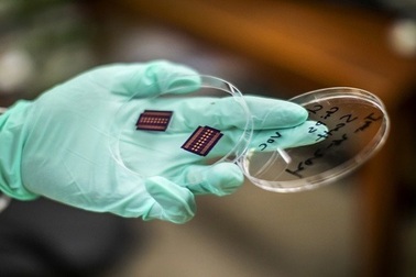 "Mũi điện tử" có thể "đánh hơi" chính xác tới 95% các loại ung thư khó phát hiện