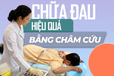 Chữa đau hiệu quả bằng châm cứu