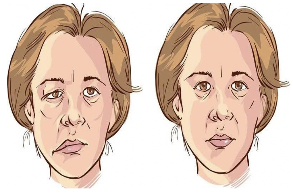 Người phụ nữ mắc căn bệnh nguy hiểm suốt 1 năm nhưng lại tưởng “điềm lành” - 1 Người phụ nữ mắc căn bệnh nguy hiểm suốt 1 năm nhưng lại tưởng “điềm lành” - 1