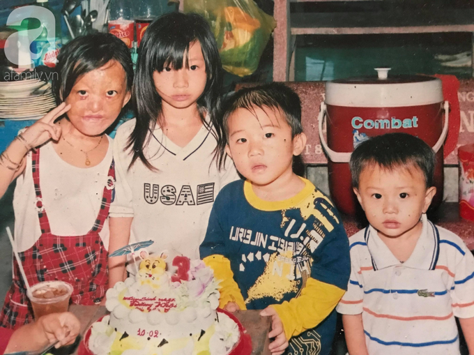 Bé gái biến dạng khuôn mặt, mất một bên tai và ước mơ nhói lòng: Em muốn làm họa sĩ để vẽ mình đẹp hơn - Ảnh 3. Bé gái biến dạng khuôn mặt, mất một bên tai và ước mơ nhói lòng: Em muốn làm họa sĩ để vẽ mình đẹp hơn - Ảnh 3.