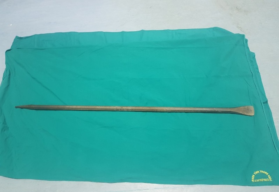 Sốc: Xà beng đâm xuyên ngực qua lưng người đàn ông  - 2