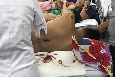 Nam thanh niên gục ngã trước lưỡi kiếm truy sát của nhóm côn đồ bịt mặt