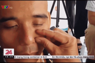 Chữa viêm xoang bằng cách bắt sâu trên mặt: Bác sĩ tai mũi họng nói gì?