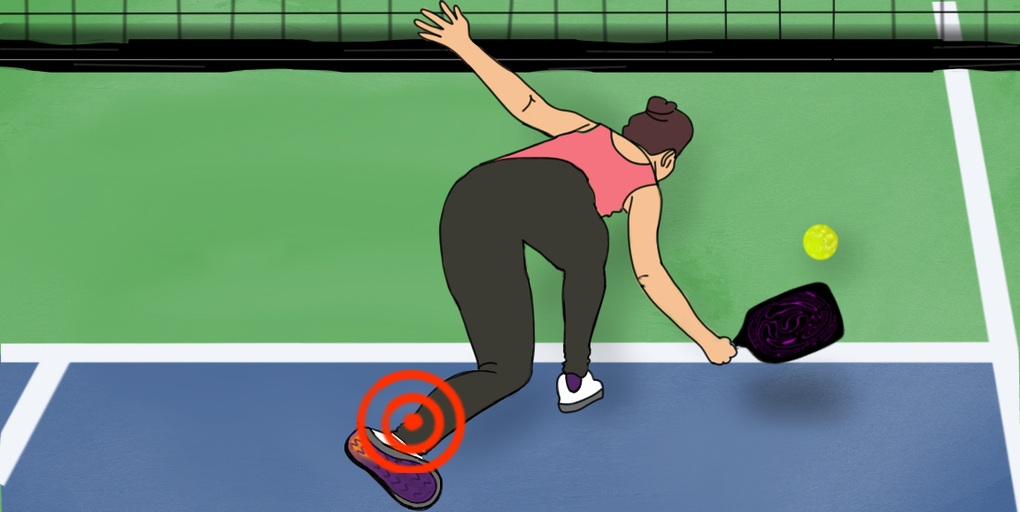 Chuyên gia đưa ra lời khuyên để tránh chấn thương khi chơi pickleball - 2 Chuyên gia đưa ra lời khuyên để tránh chấn thương khi chơi pickleball - 2