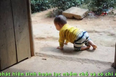 Tiếng kêu cứu của bé 1 tuổi người dân tộc Dao không có tiền đi mổ.