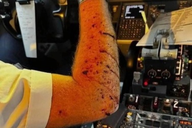 Kính chắn gió máy bay bất ngờ nổ ở độ cao 11.000m, tay của phi công bật máu