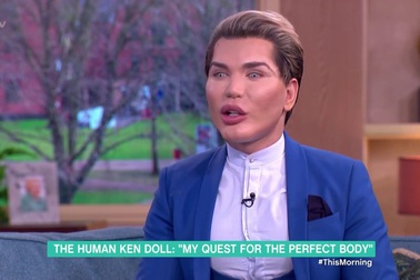 Rodrigo Alves khao khát vẻ đẹp hoàn hảo