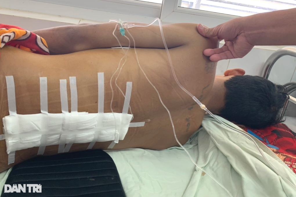 Bác sĩ kêu cứu giúp chàng trai mồ côi bị tai nạn vỡ nát xương sống - 2 Bác sĩ kêu cứu giúp chàng trai mồ côi bị tai nạn vỡ nát xương sống - 2