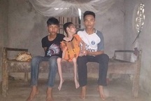 Xót xa cảnh anh trai 22 tuổi bị bại não, em 4 tuổi bị ung thư xương