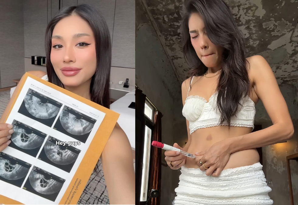 Người trẻ đông lạnh trứng để không bị áp lực kết hôn khi già - 1 Người trẻ đông lạnh trứng để không bị áp lực kết hôn khi già - 1