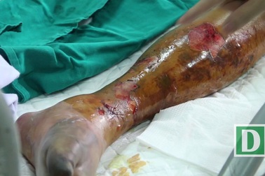 Hãi hùng với những hình ảnh liên cầu lợn “tấn công” người