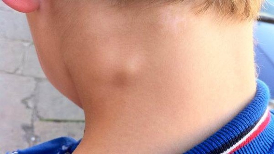 Cái chết đen: Dịch bệnh từng quét sạch một nửa dân số châu Âu - 2 Cái chết đen: Dịch bệnh từng quét sạch một nửa dân số châu Âu - 2