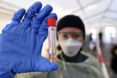 Virus SARS-CoV-2 ở ổ dịch đông bắc Trung Quốc khác virus ở Vũ Hán?