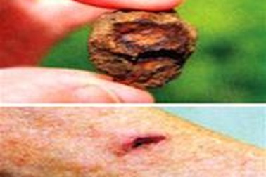 Cụ bà 76 tuổi bị trúng "đạn" từ... vũ trụ!  