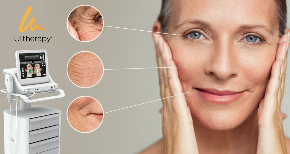 Đẩy lùi lão hóa sớm với công nghệ nâng cơ, căng da Ultherapy - 2 Đẩy lùi lão hóa sớm với công nghệ nâng cơ, căng da Ultherapy - 2