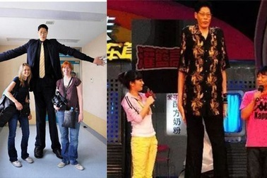 Căn bệnh "quái" khiến người đàn ông cao 2m42 lấy vợ 19 năm không có con