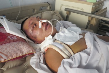 Bố bị tai nạn giao thông, cả gia đình rơi vào bĩ cực