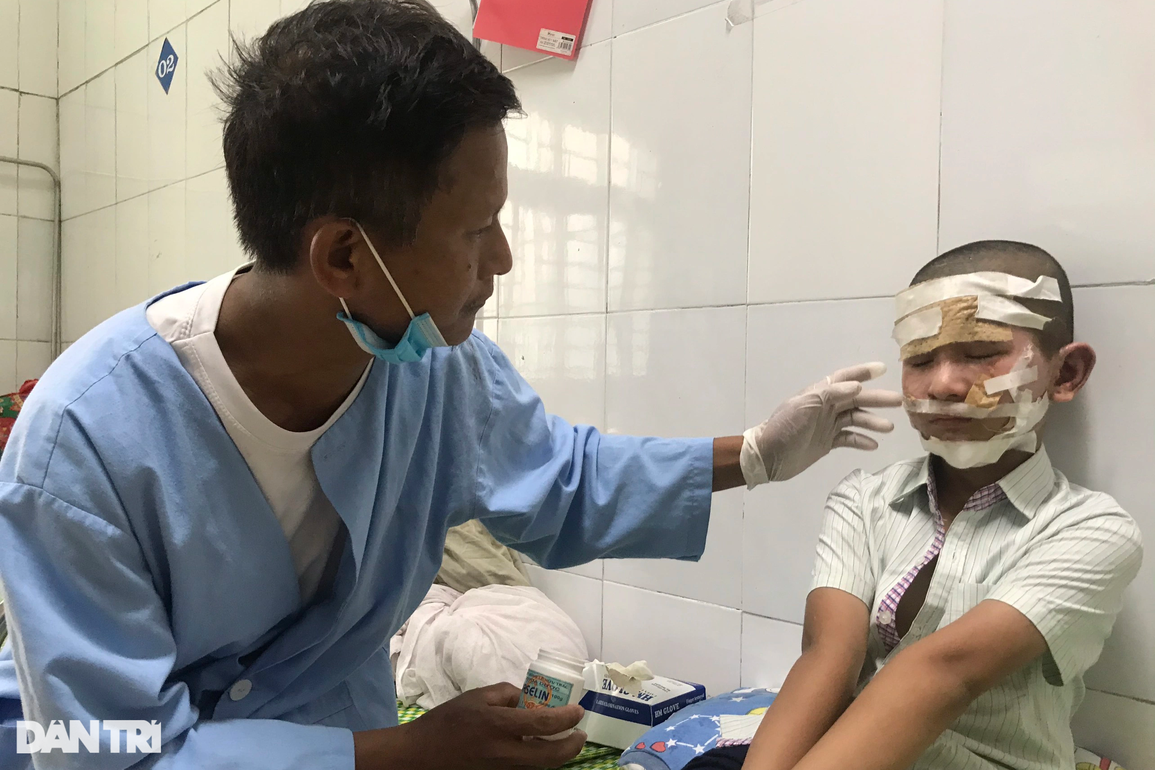 Cơ cực gia đình nghèo và tai họa đổ ập xuống 3 con nhỏ bị bỏng nặng - 4 Cơ cực gia đình nghèo và tai họa đổ ập xuống 3 con nhỏ bị bỏng nặng - 4