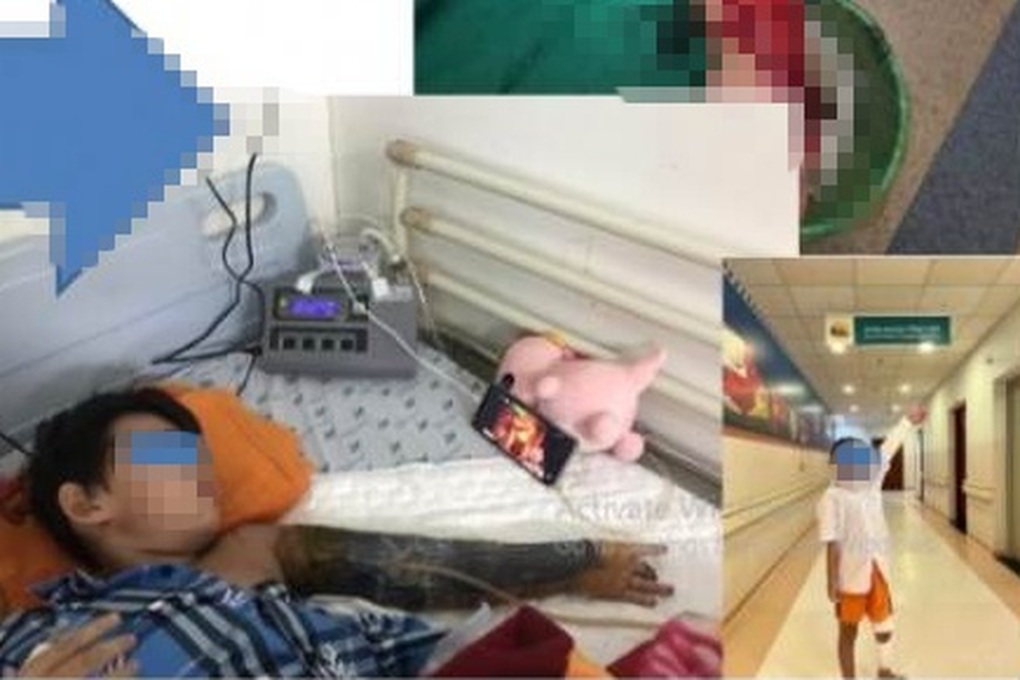 Bé trai 7 tuổi bị máy trộn bê tông cuốn nát tay khi đi chơi ở công trình - 2 Bé trai 7 tuổi bị máy trộn bê tông cuốn nát tay khi đi chơi ở công trình - 2