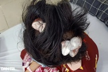 Lời kể của mẹ bé gái 16 tuổi bị cha dượng đánh nhập viện