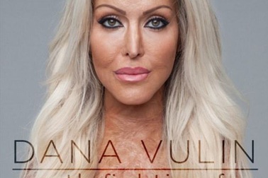 Qua 2 năm cùng 200 cuộc phẫu thuật từ vụ đánh ghen kinh hoàng, cô gái lại xinh đẹp như xưa