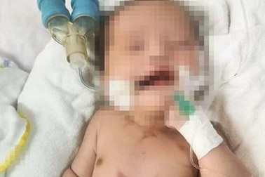 Bé 16 ngày tuổi nguy kịch, nhập viện với nhiều vết chích của "lang vườn"