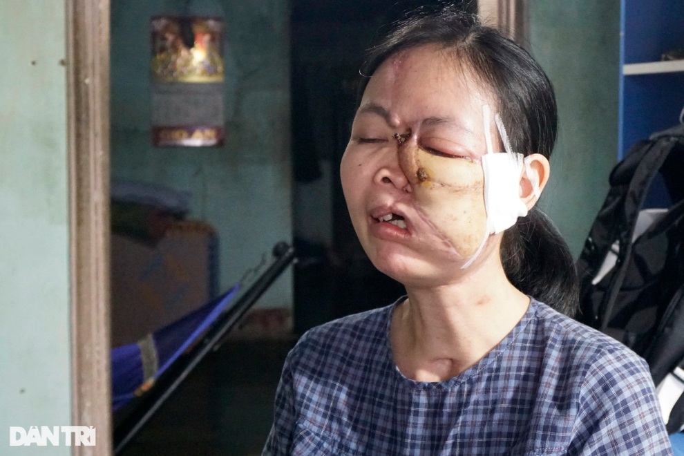 Cô gái đau khổ bởi hễ ra đường là trẻ con vừa thấy đã khóc thét, bỏ chạy - 1 Cô gái đau khổ bởi hễ ra đường là trẻ con vừa thấy đã khóc thét, bỏ chạy - 1
