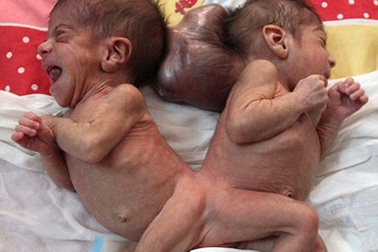 Quốc vương Ảrập Xê-út làm “người hùng”