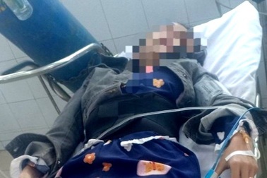 Chia sẻ của thiếu nữ trong vụ "nhảy lầu quán karaoke vì bị ép tiếp khách"