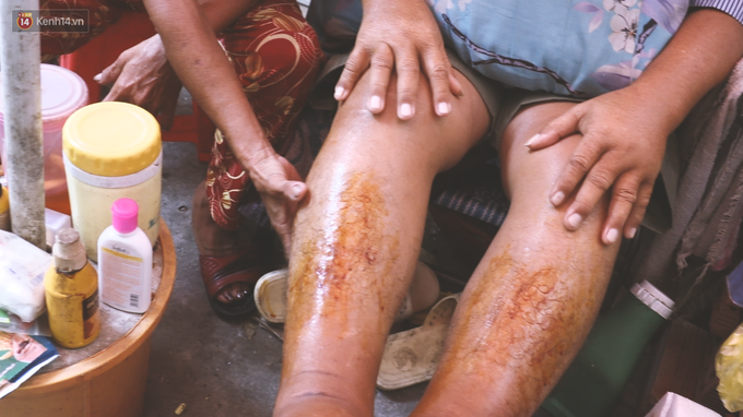 Vợ điếc, chồng mù sống trong căn nhà 1m2 giữa Sài Gòn: Bây giờ có tiền, vào viện cũng không ai chăm nuôi... - Ảnh 6. Vợ điếc, chồng mù sống trong căn nhà 1m2 giữa Sài Gòn: Bây giờ có tiền, vào viện cũng không ai chăm nuôi... - Ảnh 6.