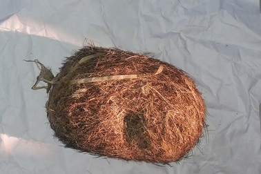 Mổ lợn 100kg, phát hiện vật nghi “cát lợn” quý hiếm