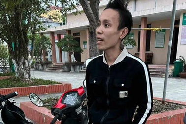 Tên cướp đấm vỡ hốc mắt nạn nhân khi bị truy đuổi