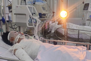 Dồn dập tai nạn pháo nổ đau lòng: Bỏng khắp người, tử vong khi chuyển viện