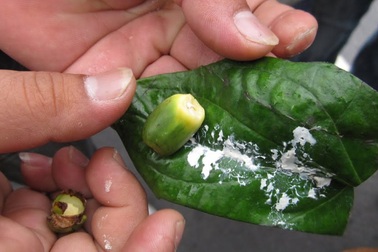 Mắc ung thư miệng vì thói quen ăn trầu để tỉnh táo khi lái xe