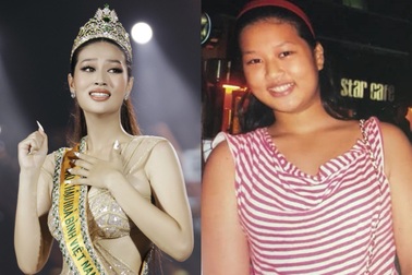 Tân Hoa hậu Thiên Ân: Từng nặng 75kg, bị rạn da vùng ngực vì giảm cân nhanh