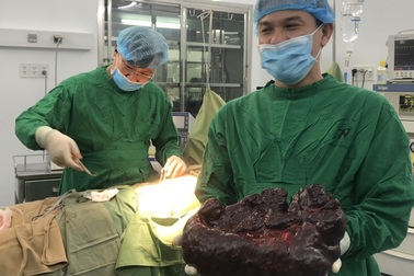 Nữ bệnh nhân mang u lách như cây nấm khổng lồ