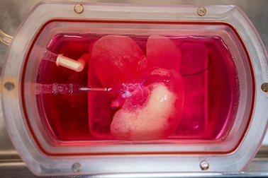 Cấy ghép thành công gan người “thu nhỏ” vào chuột